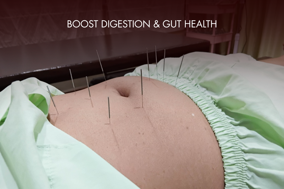 Acupuncture Treatment By Licensed Practitioner