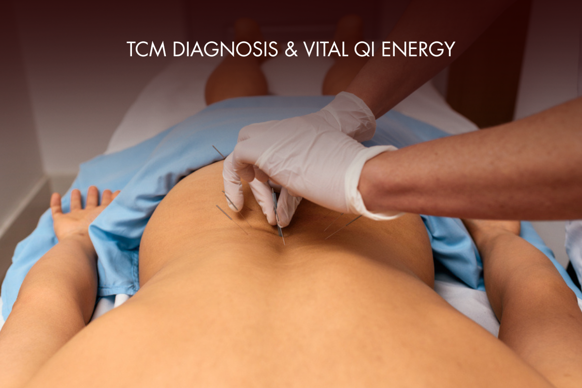 Acupuncture Treatment By Licensed Practitioner