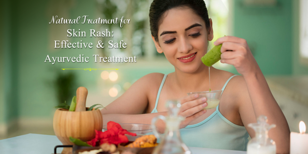 natural treatments for skin rash